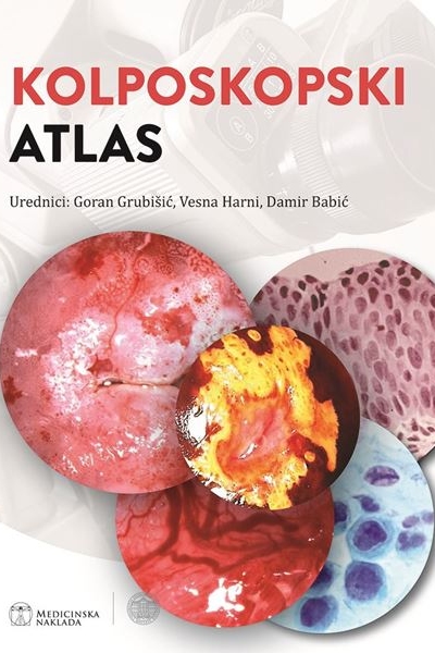 Kolposkopski atlas (ur.) Goran Grubišić, Vesna Harni, Damir Babić  Medicinska naklada