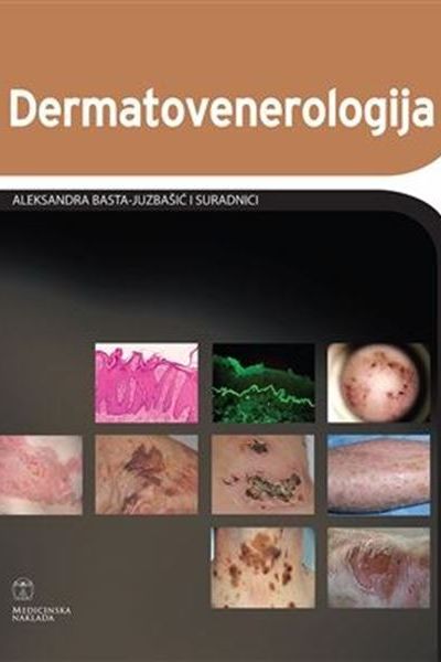 Dermatovenerologija Aleksandra Basta-Juzbašić i sur. Medicinska naklada